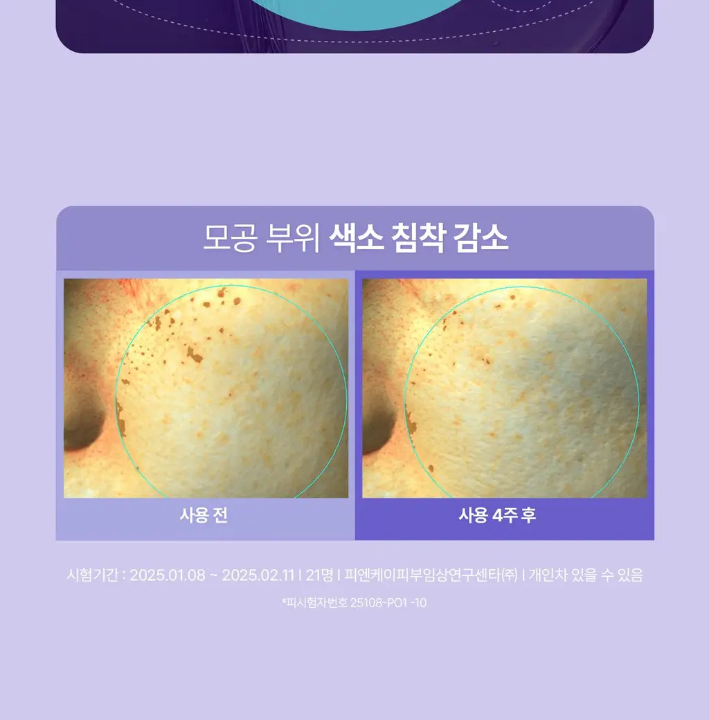 [모공PDRN] 리쥬란 더마 힐러 포어 타이트닝 앰플 30ml [한정기획(+토너패드2매X6)/단품]_올영픽 상세페이지 18